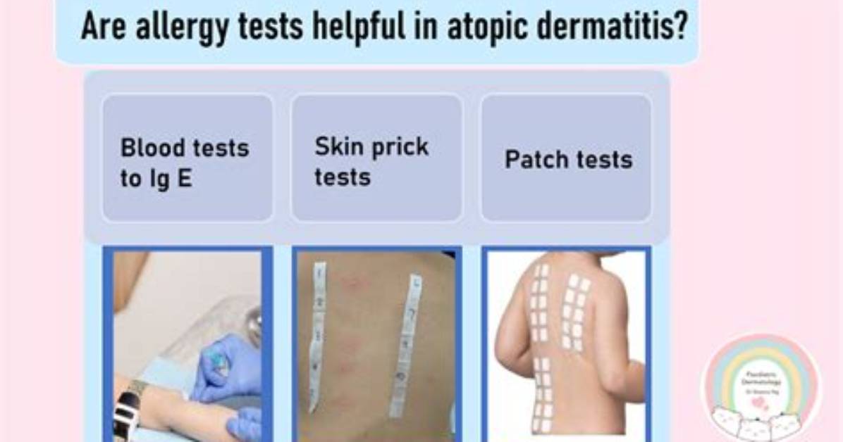 Where Do I Get Allergy Testing Done?