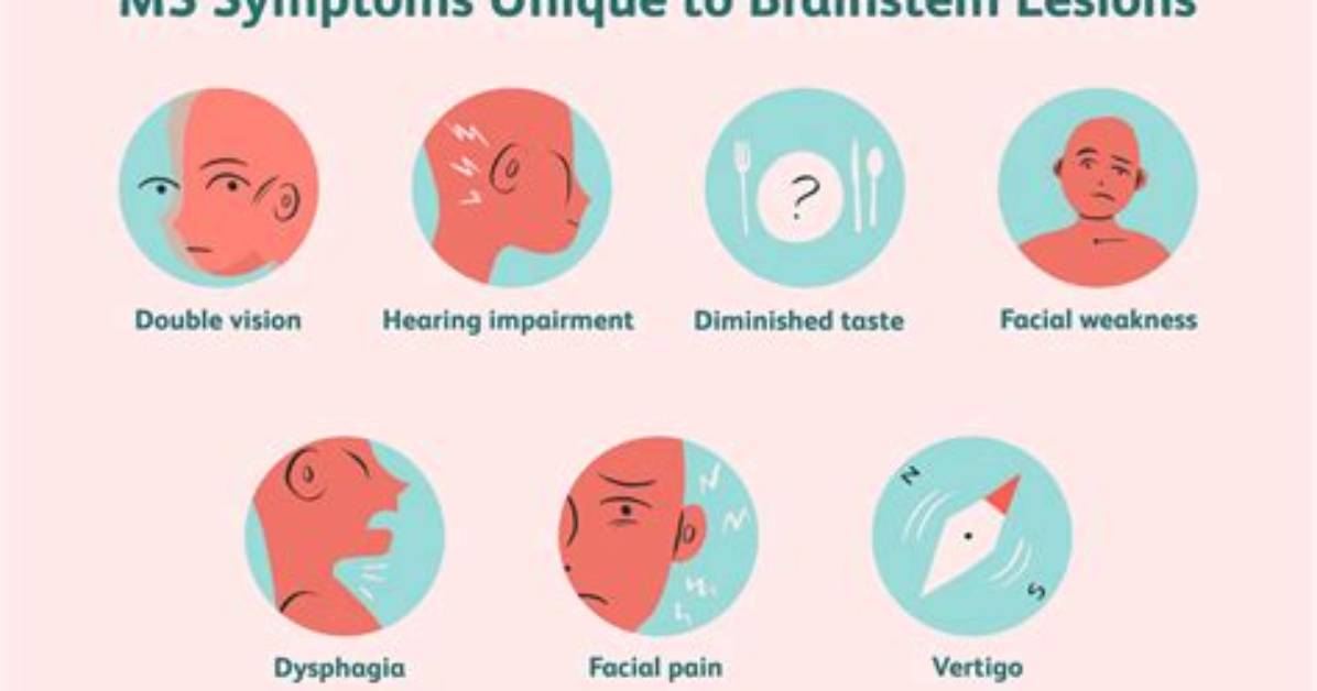 Where Do Ms Lesions Appear?