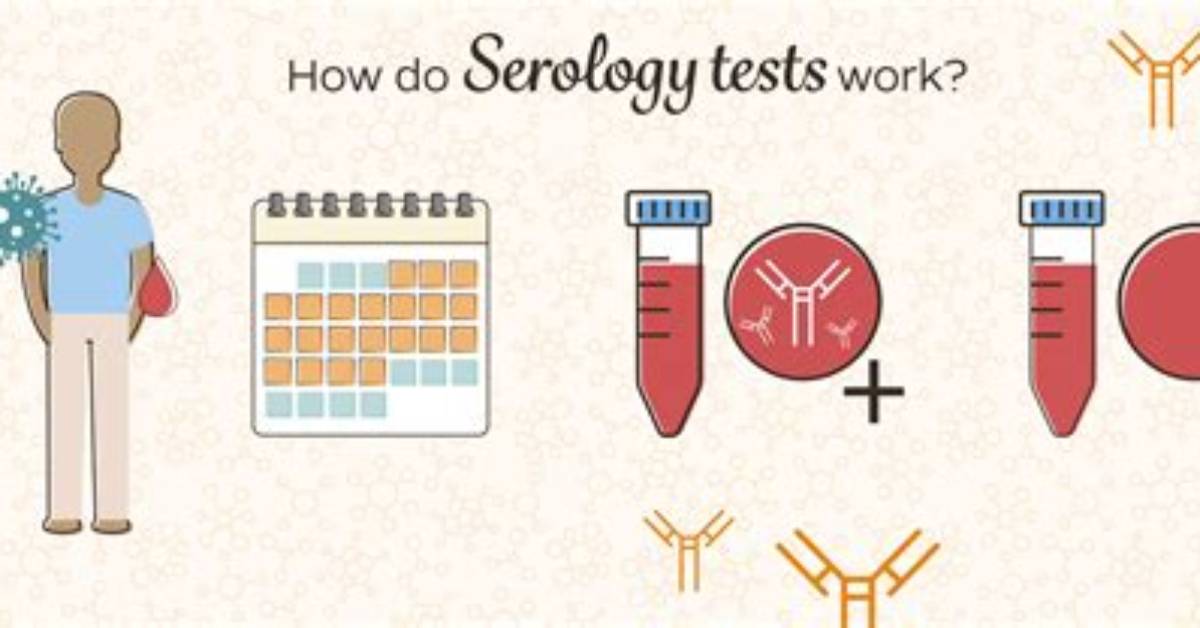 Where Do Serologist Work?