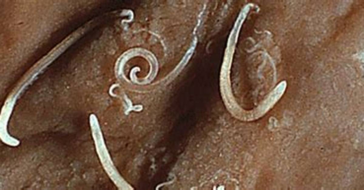 Where Do Whipworms Live?