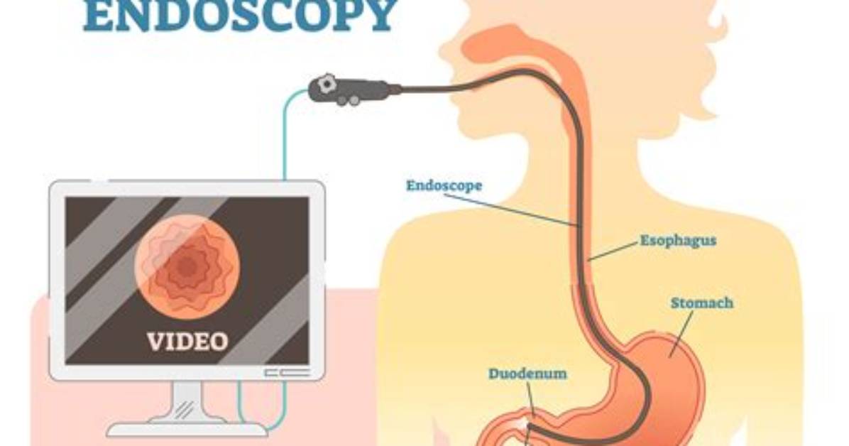 Where Does a Gastroscopy Go?