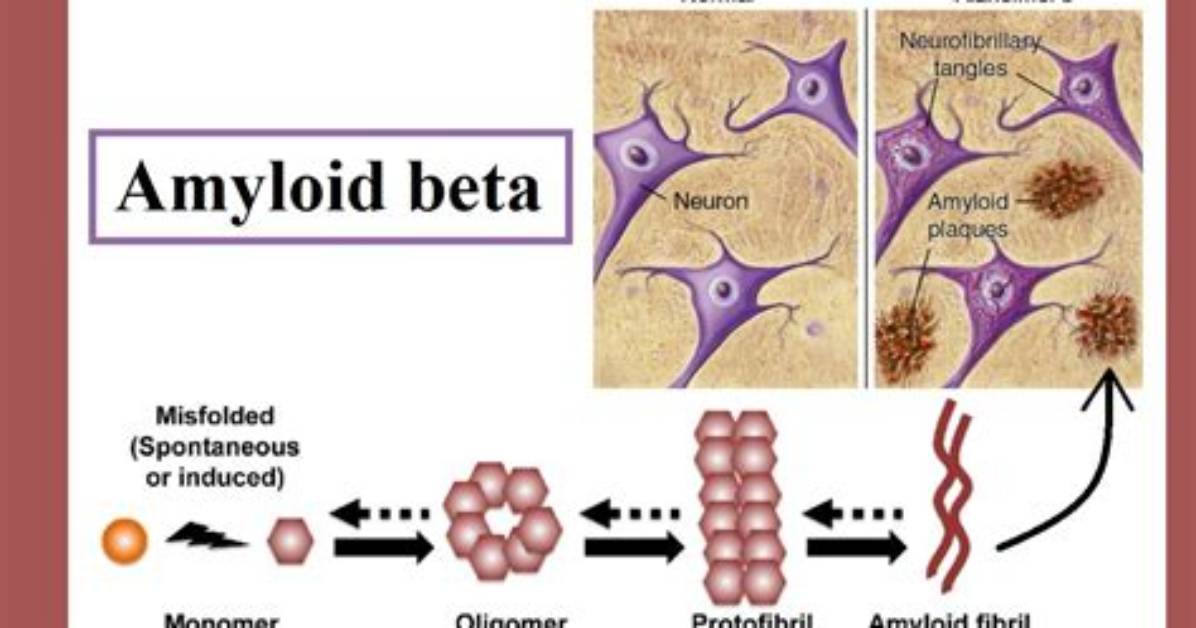 Where Does Amyloid Beta Come from?
