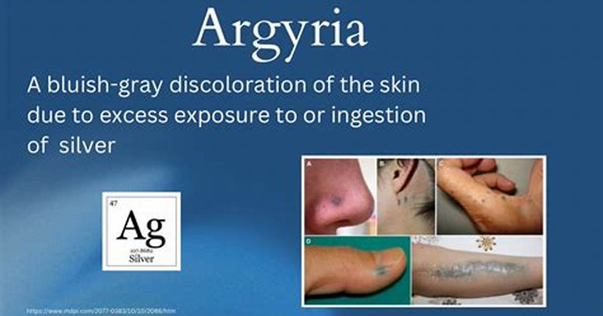 Where Does Argyria Start?