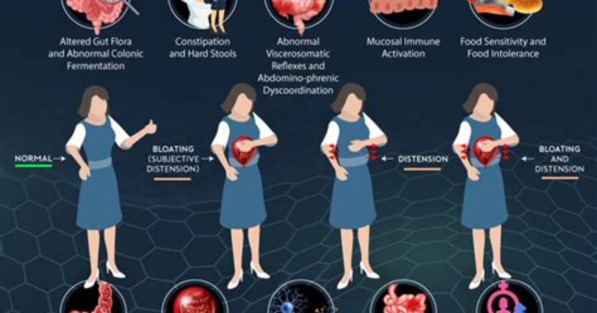 Where Does Bloating Occur?