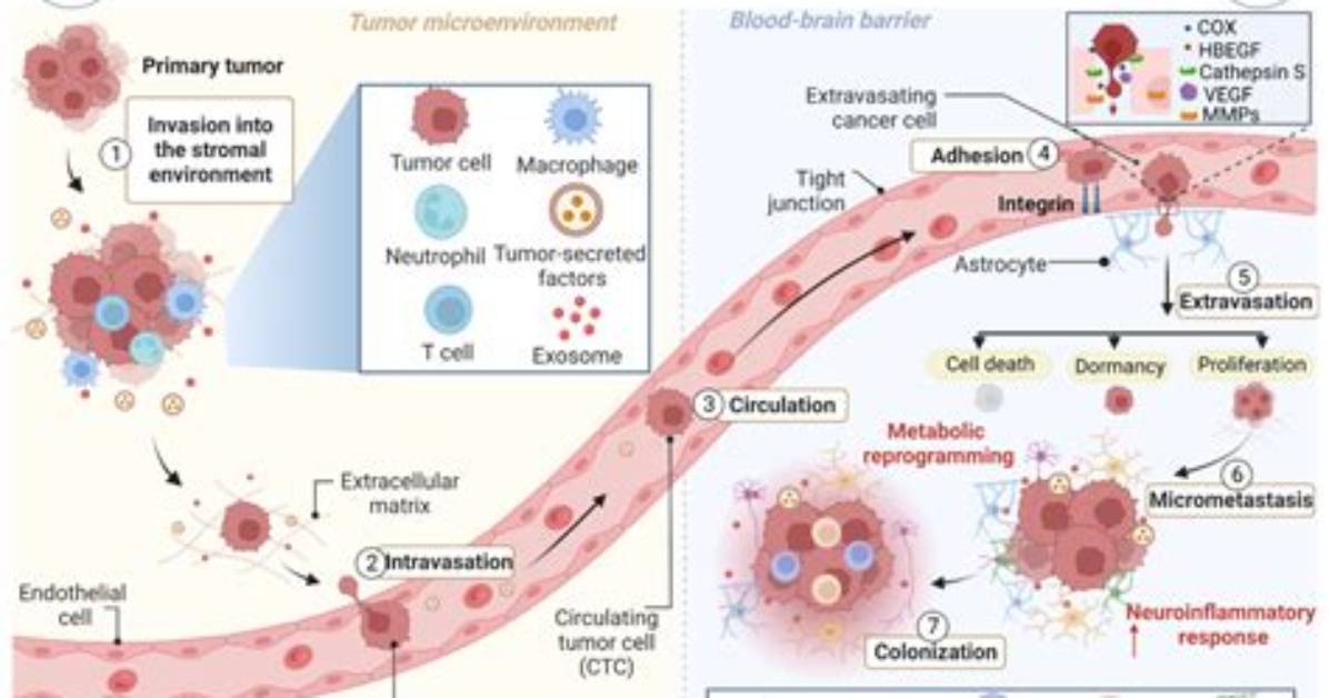 Where Does Metastasis Spread to?