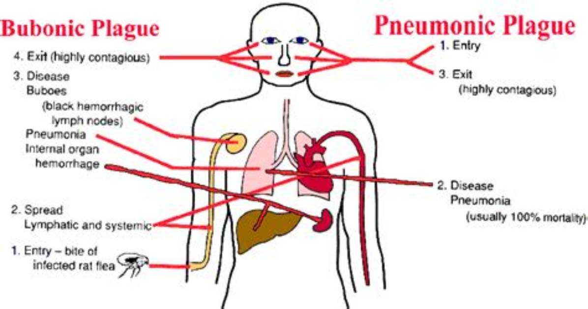 Where Does Pneumonic Plague Come from?