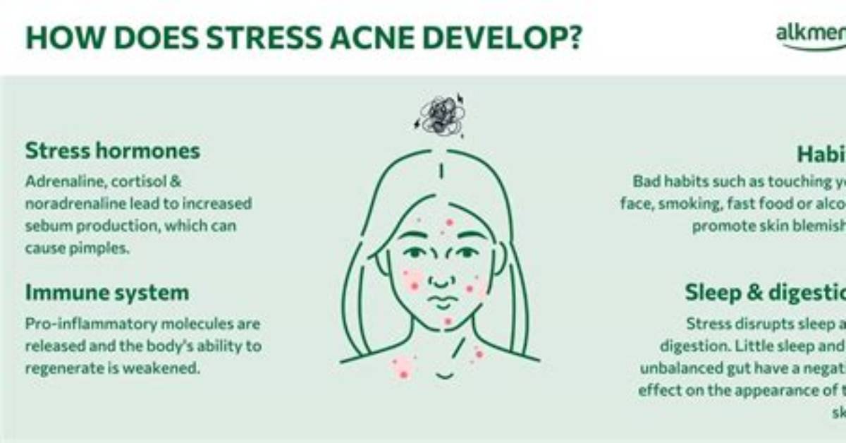 Where Does Stress Cause Breakouts?