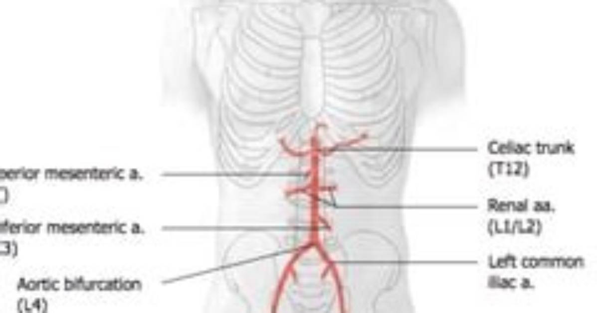 Where Does the Abdominal Aorta Bifurcate?