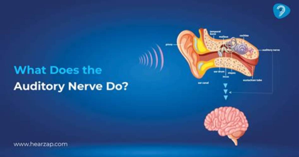 Where Does the Auditory Nerve Go in the Brain