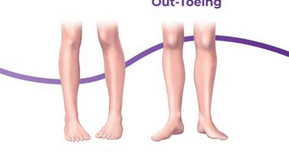 Where Does Toeing the Line Come from?