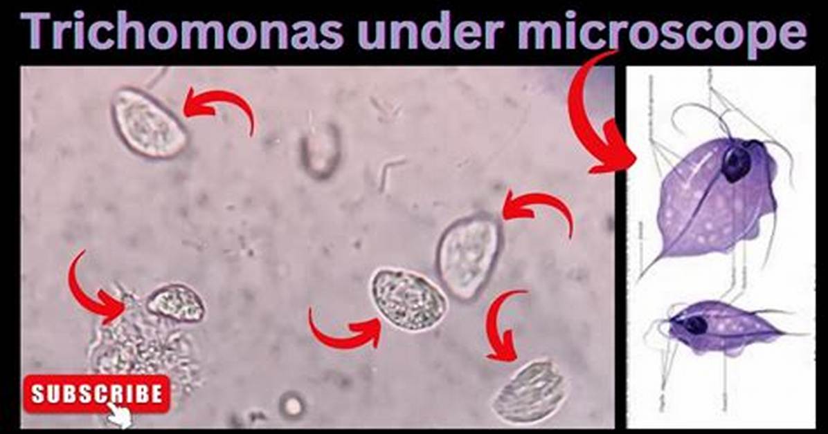 Where Does Trichomonas Come from?