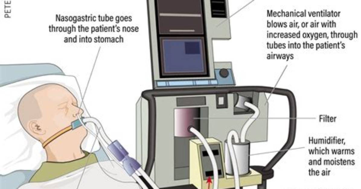 Where Does Ventilator Go?
