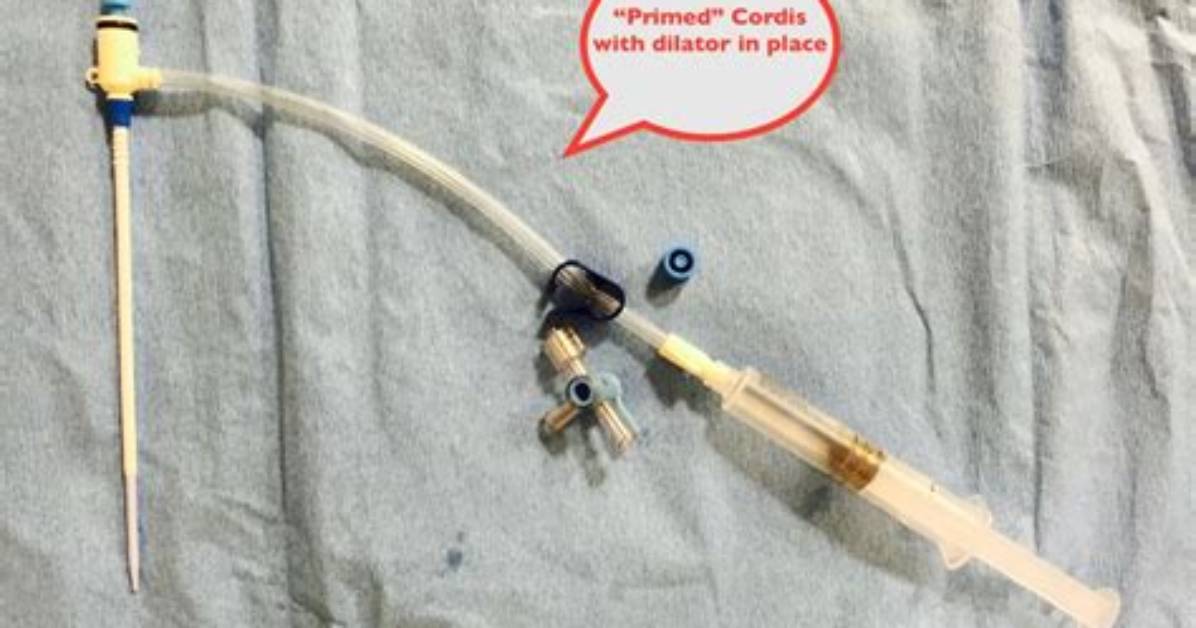 Where Is a Cordis Placed?