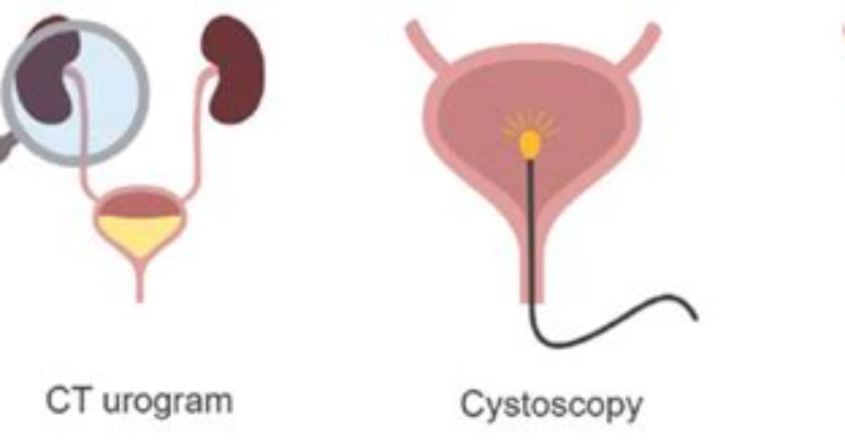 Where Is a Cystogram Performed?