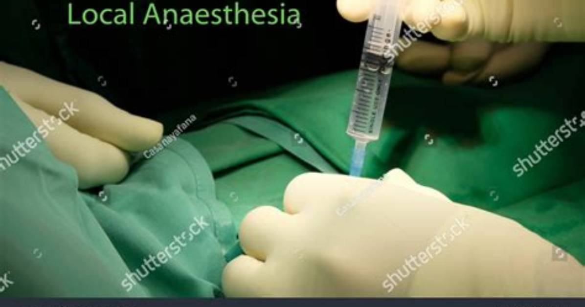 Where Is Anaesthesia Given?