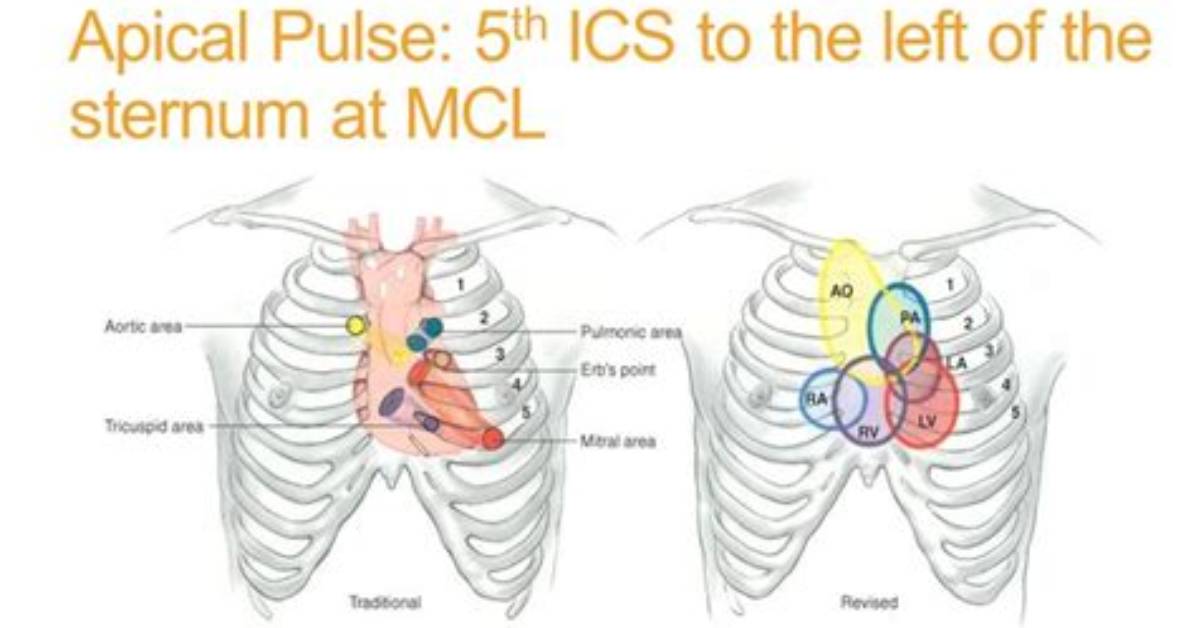 Where Is Apical Located