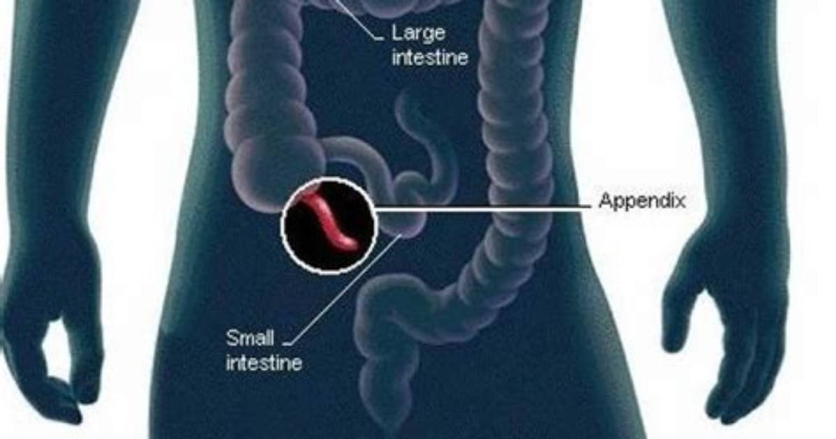 Where Is Appendix Side?
