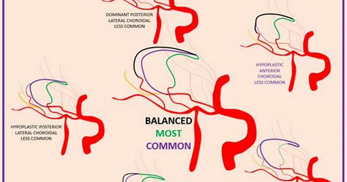 Where Is Choroidal Artery?