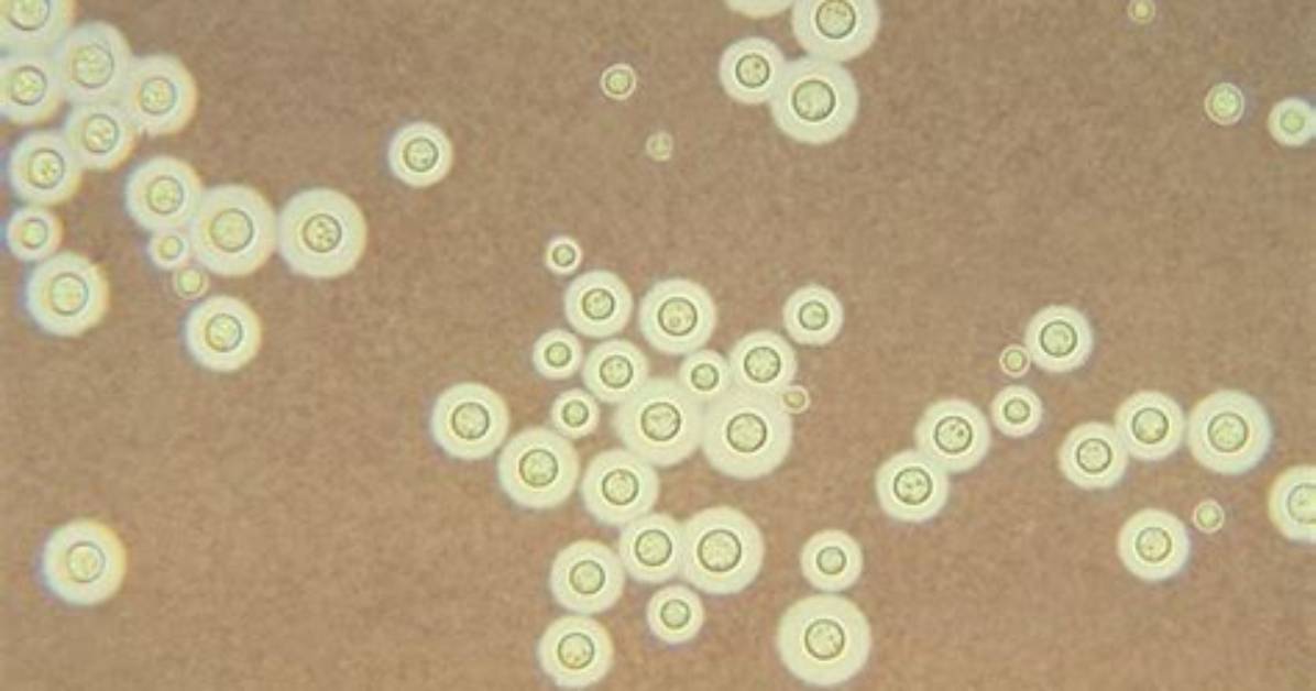 Where Is Cryptococcus Found?