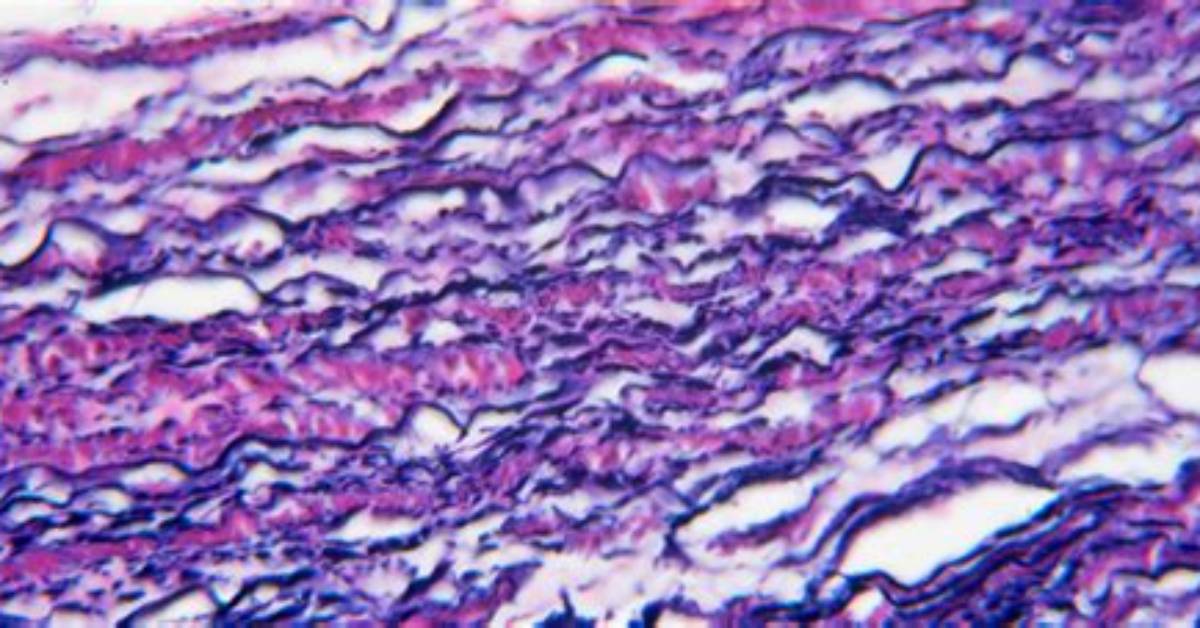 Where Is Dense Elastic Connective Tissue Found?