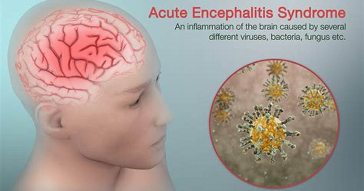 Where Is Encephalitis Found?