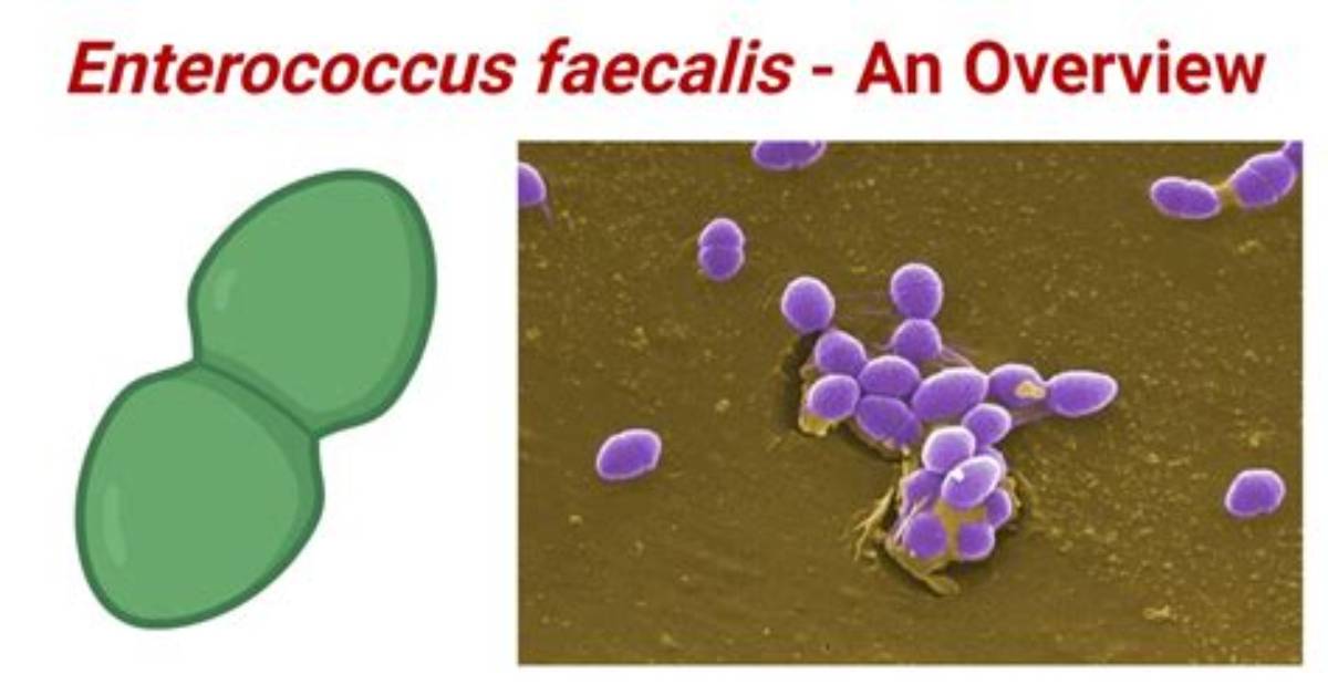 Where Is Enterococcus Faecalis Normally Found