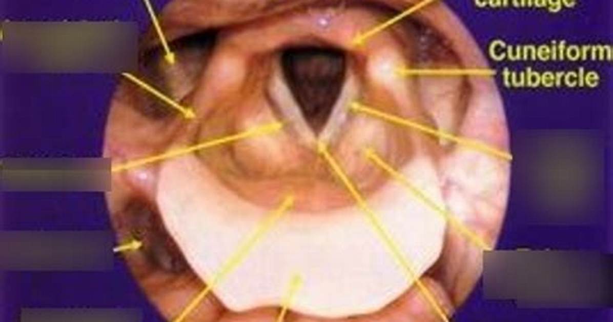 Where Is Epiglottic Petiole?