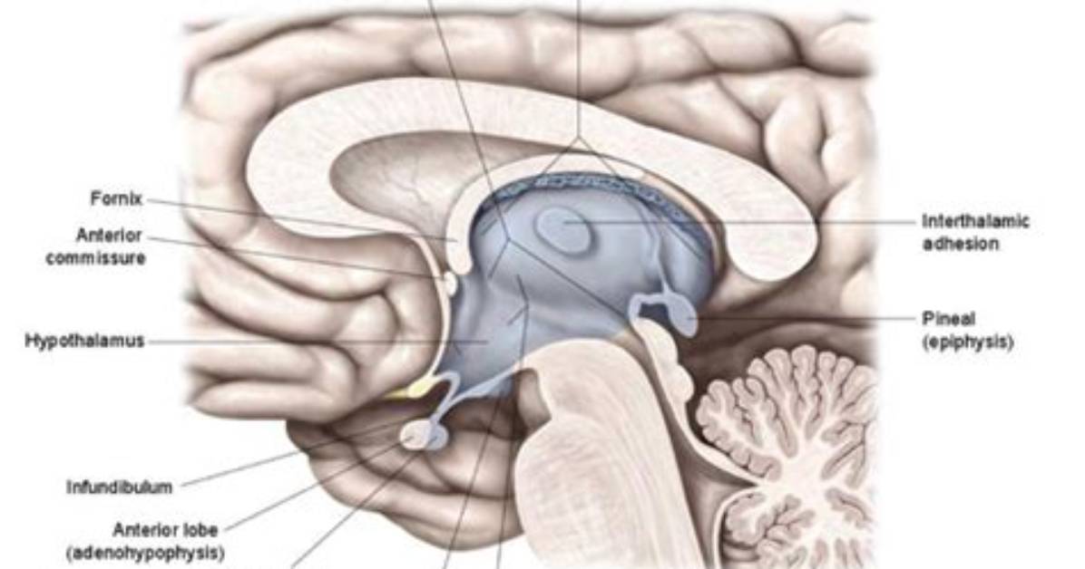 Where Is Hypothalamic Sulcus?