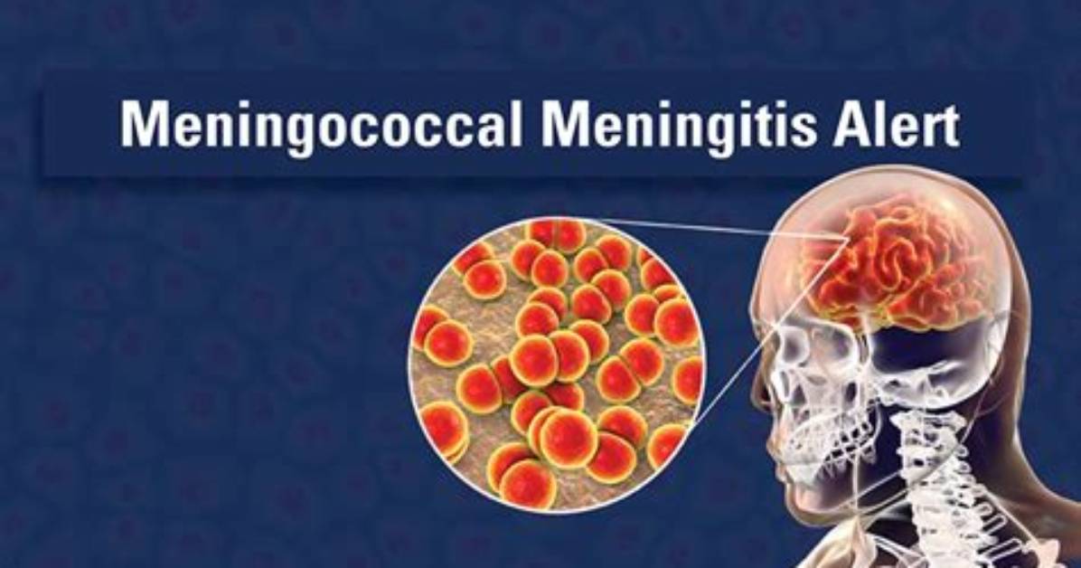 Where Is Meningococcal Bacteria Found?