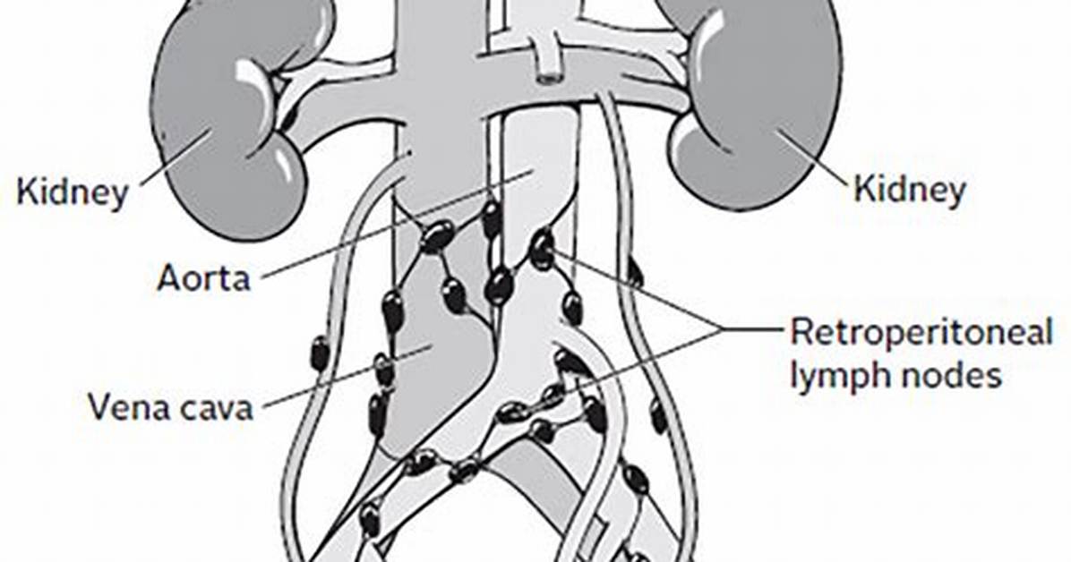 Where Is Periportal Lymph Node?