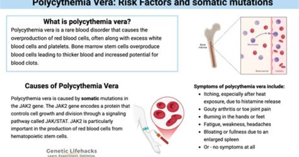 Where Is Polycythemia Vera Located?