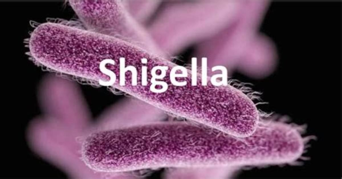 Where Is Shigella Found?