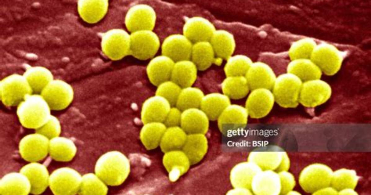 Where Is Staphylococcus Aureus Found
