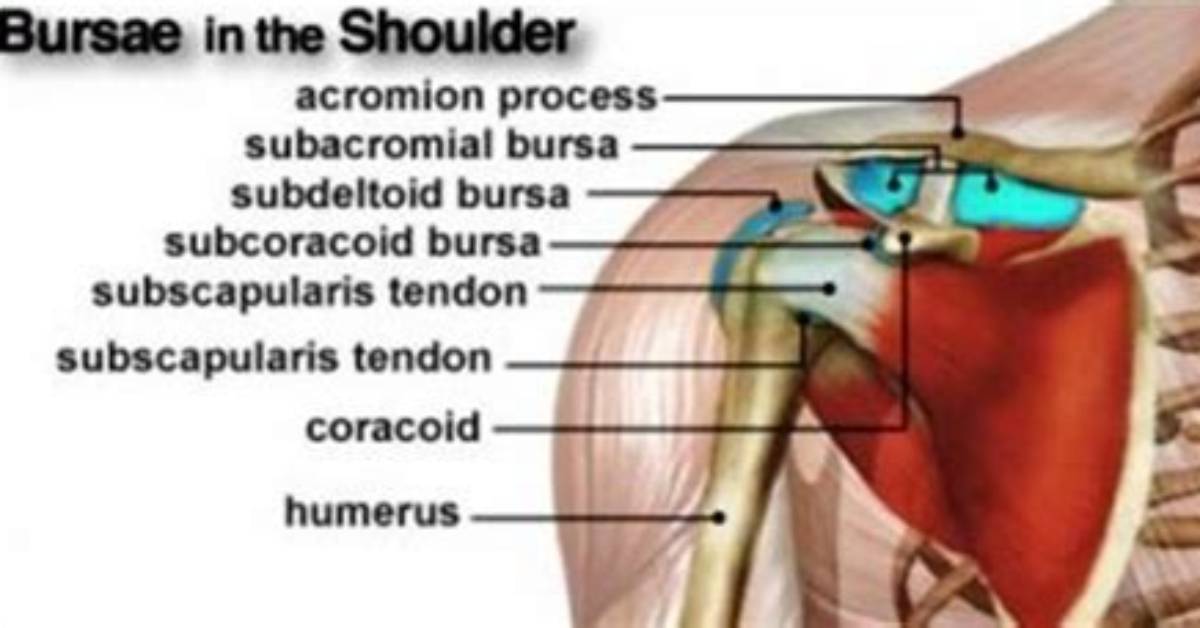 Where Is Subcoracoid Bursa Located?