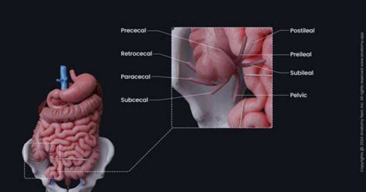Where Is the Appendiceal Located?