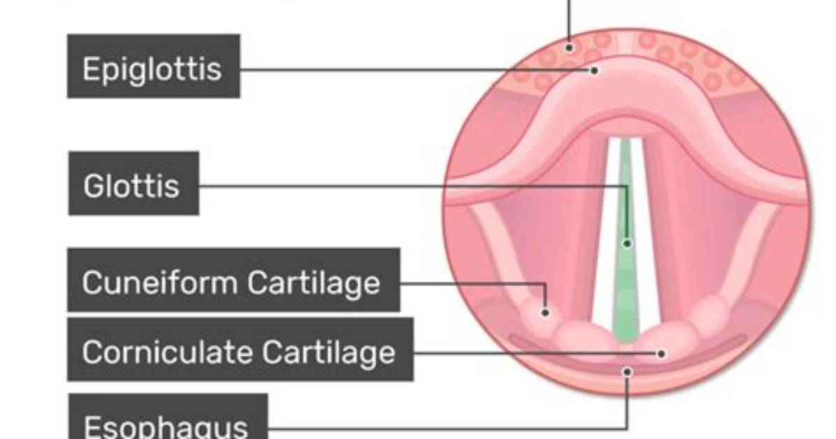 Where Is the Glottic Cleft?