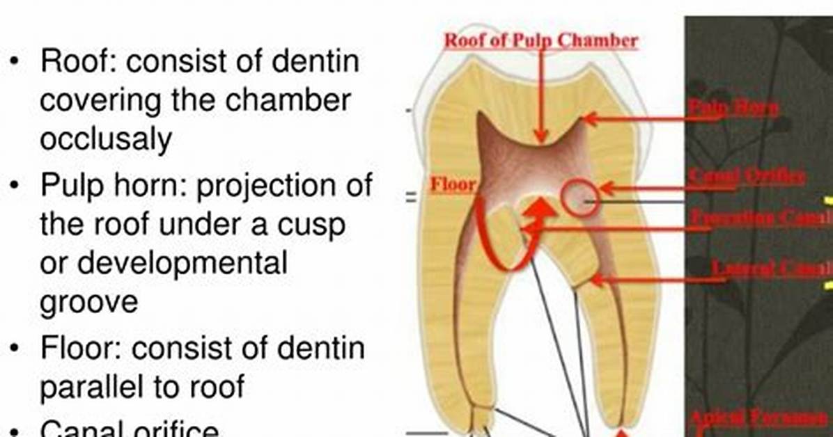 Where Is the Pulp Chamber?