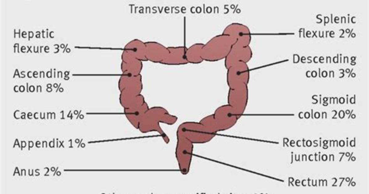 Where Is the Rectosigmoid Located?