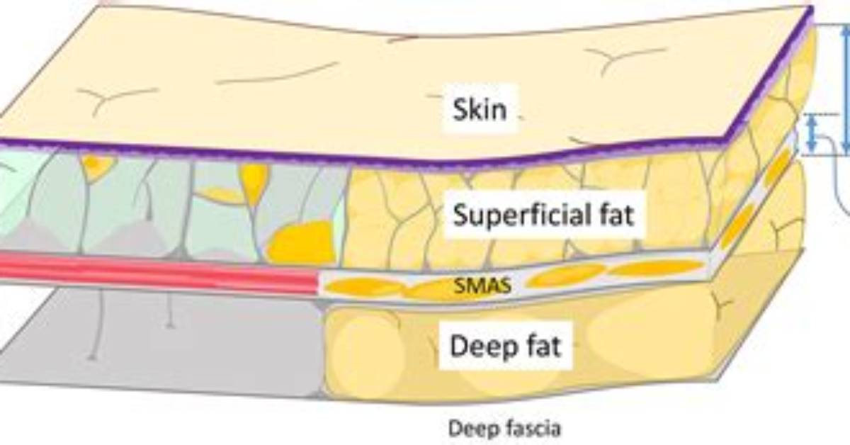 Where Is the Smas Layer?