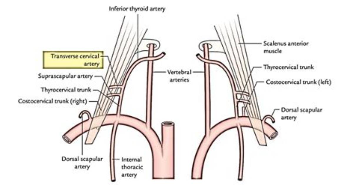 Where Is the Thyrocervical Trunk?