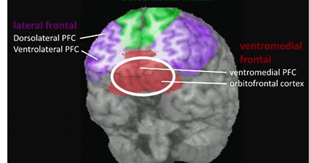 Where Is the Ventrolateral Located?