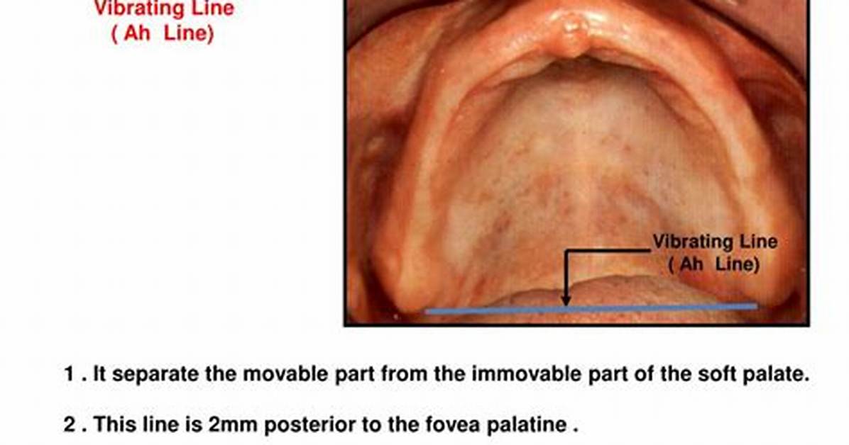 Where Is Vibrating Line Located?