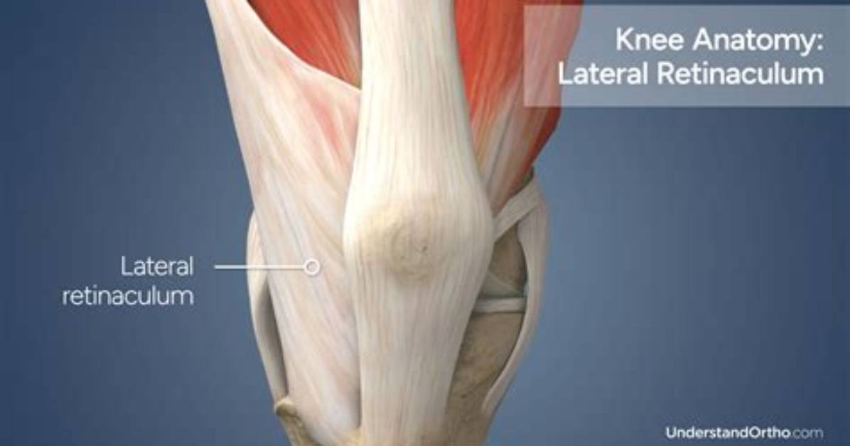 Where Is Your Retinaculum?