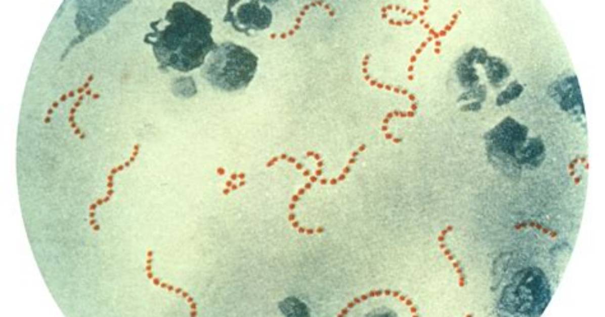 Where Streptococcus Pyogenes Can Be Found?