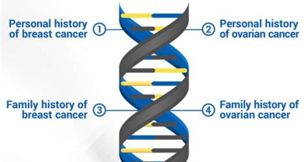 Where to Get Brca Testing Done?