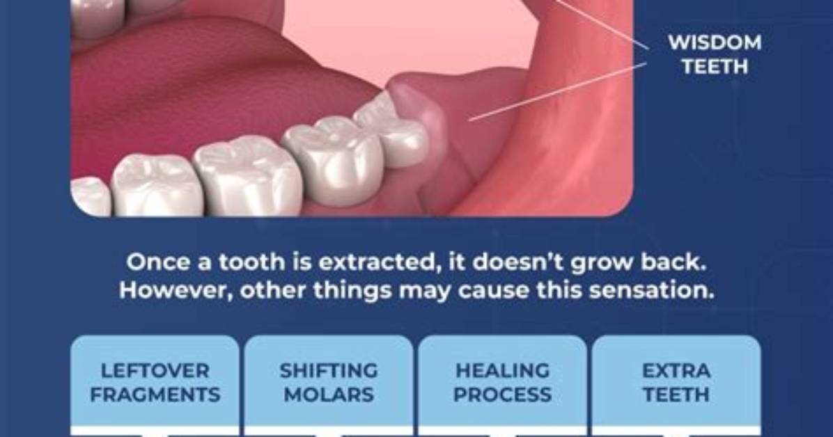 Where Wisdom Teeth Grow?