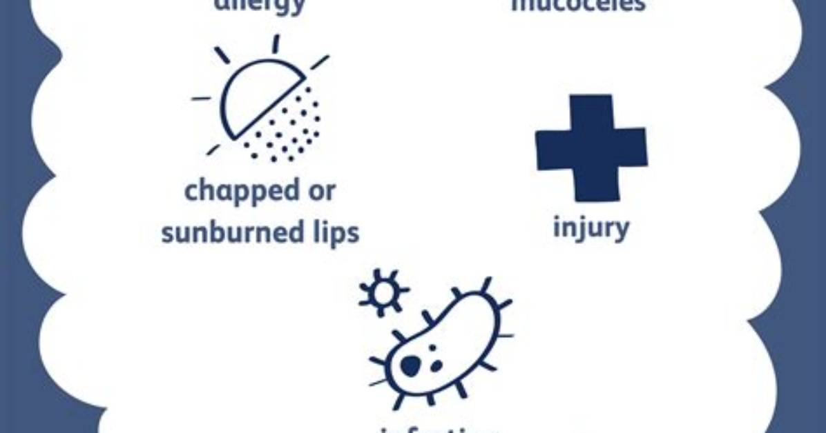 Which Allergy Causes Swollen Lips?