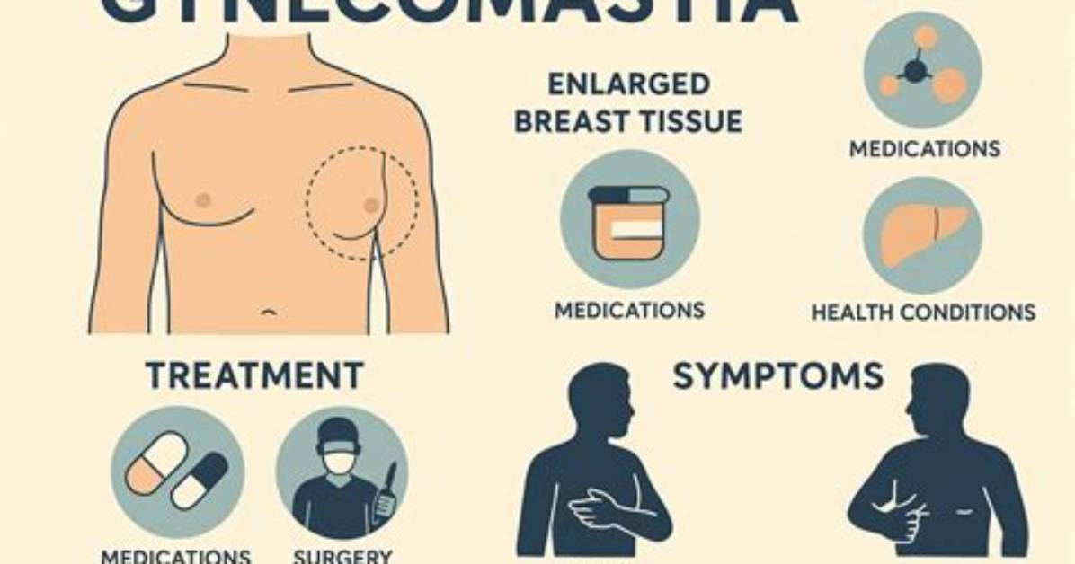 Which Antipsychotic Causes Gynecomastia? | Contextresponse. Com
