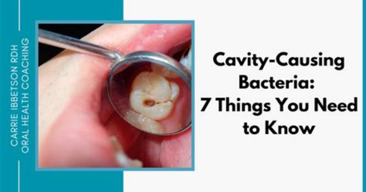 Which Bacteria Causes Cavities?