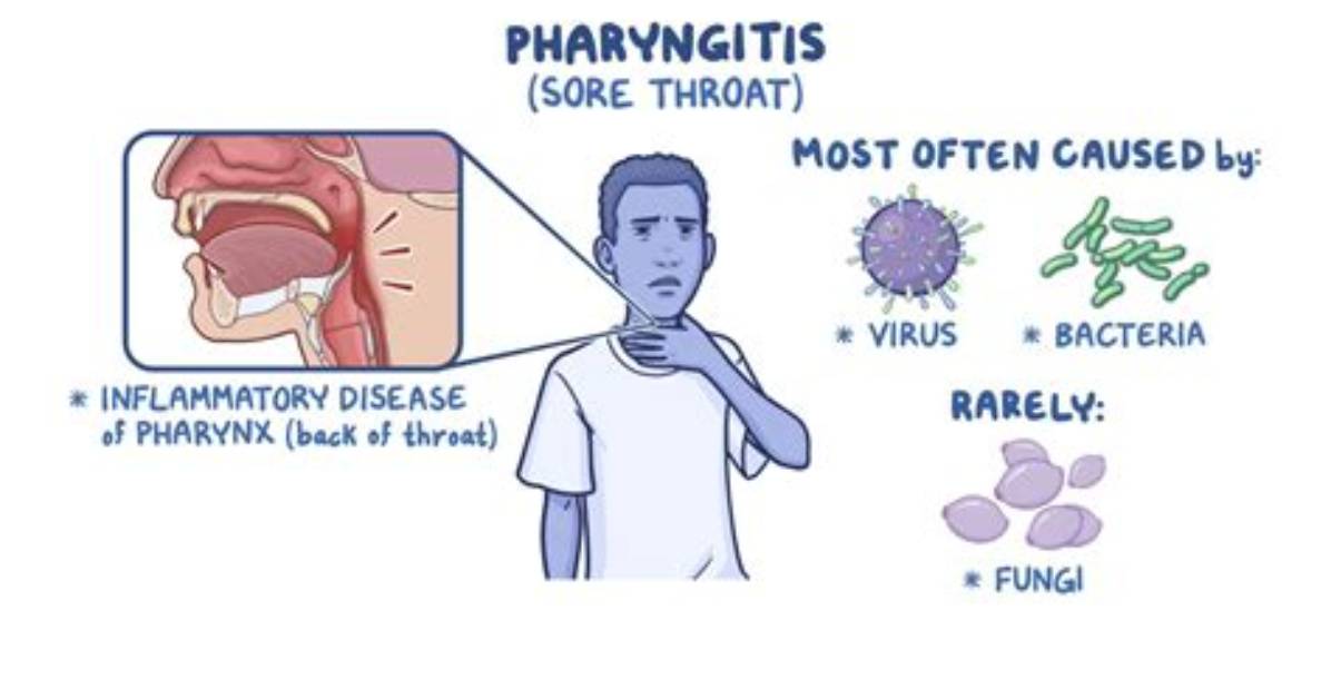 Which Bacteria Causes Pharyngitis?